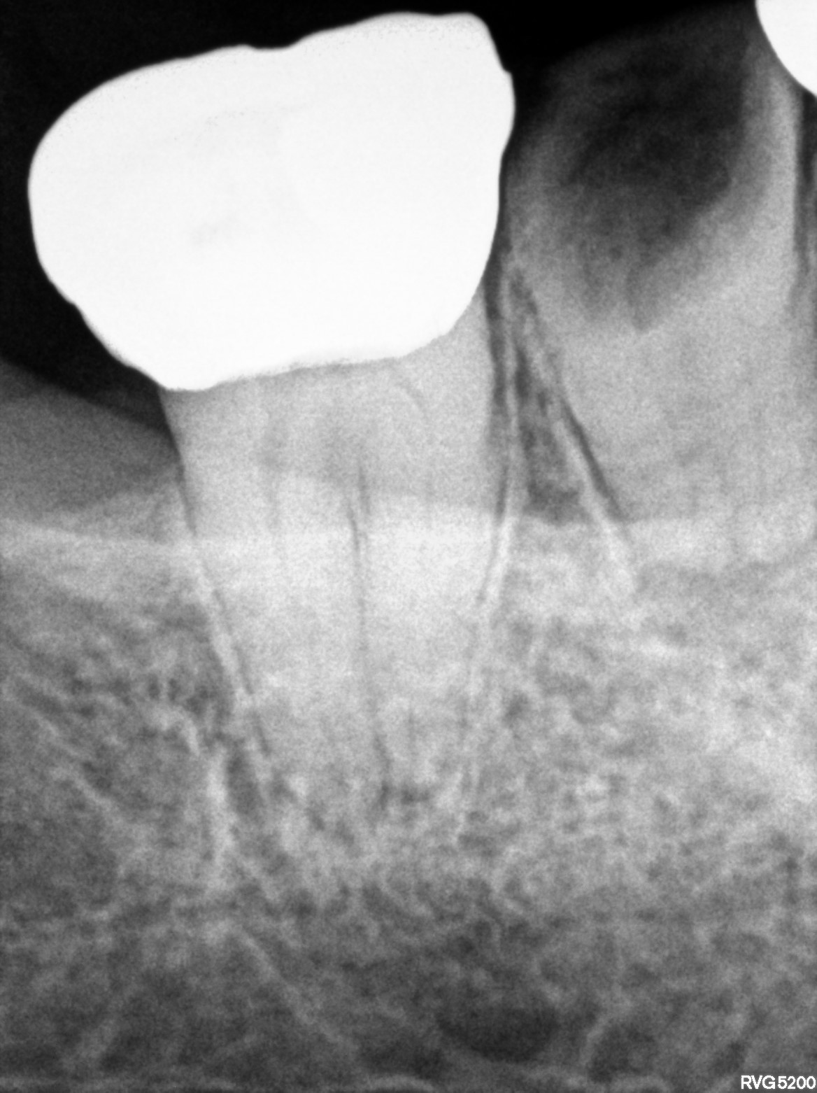 Dental X-ray